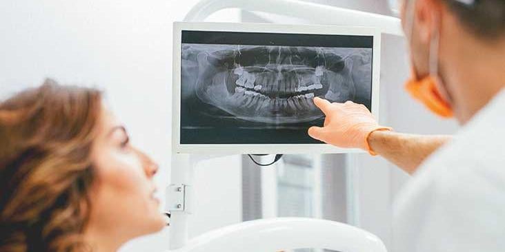 x-rays