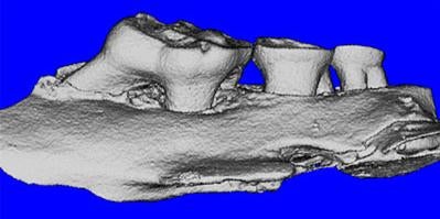 microct