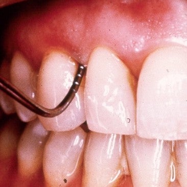 dental care